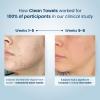 imageClean Skin Club Clean Towels 100 USDA Biobased Dermatologist Approved Face Towel Disposable Clinically Tested Face Towelette Facial Washcloth Ultra Soft Makeup Remover Dry Wipes 1 pack 25 ct25 Count Pack of 1