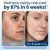 image:imageClean Skin Club Clean Towels Large 100 USDA Biobased Face Towel Disposable Face Towelette Eczema Association Accepted Makeup Remover Dry Wipes Ultra Soft 1 Pack 50 Ct